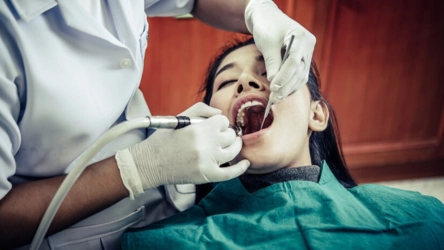 dental-filling